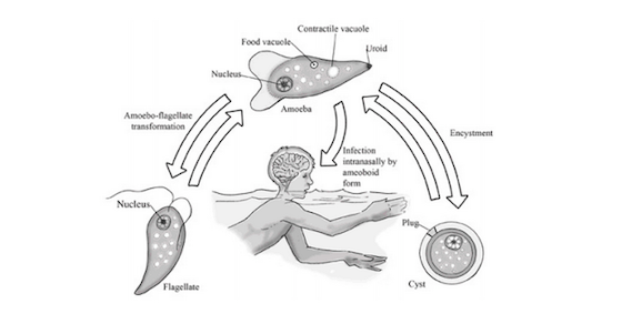 Amoeba